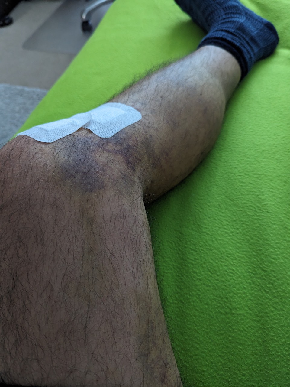 Knee on May 10, 2023